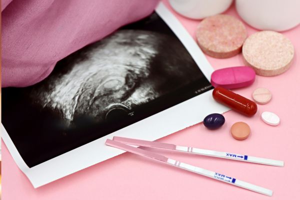 A photo of a sonogram and medical interventions tried for infertility